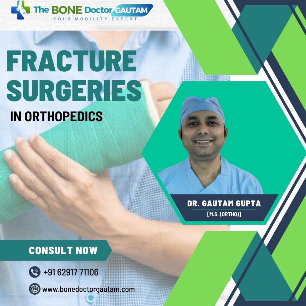 Fracture Surgeries in Orthopedics