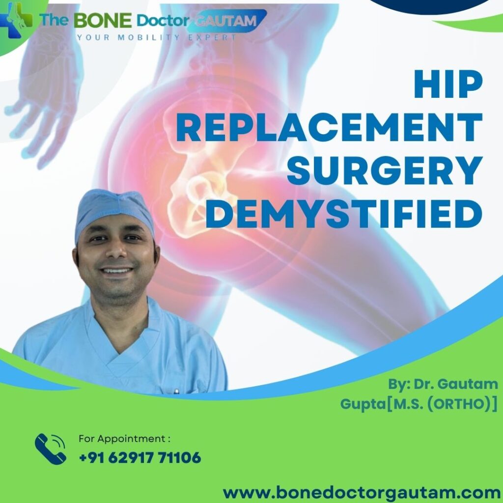 Hip Replacement Surgery Demystified