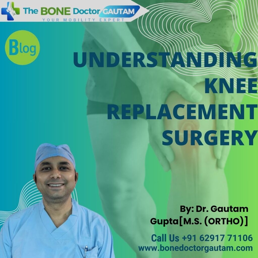 Understanding Knee Replacement Surgery