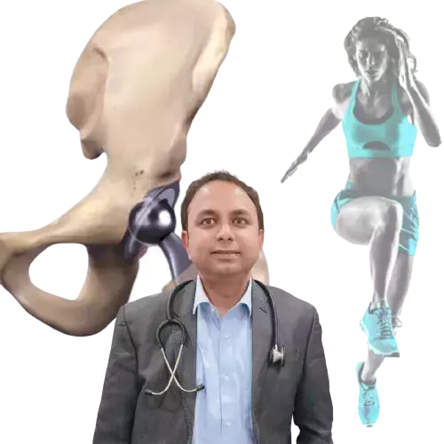 Hip Replacement Surgery In Kolkata
