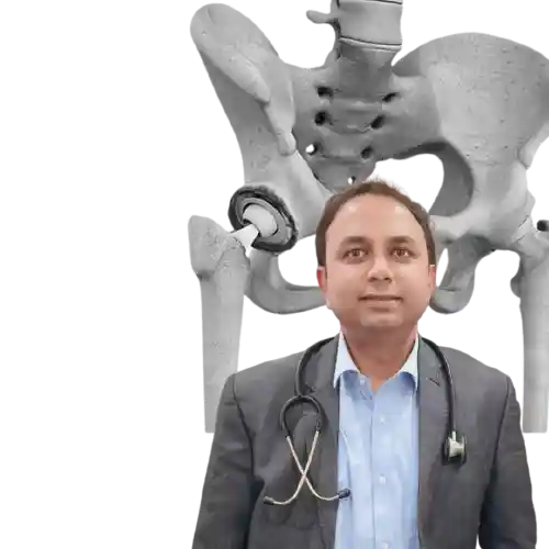 Minimally Invasive Hip Replacement In Kolkata