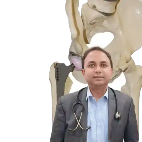 Hip Resurfacing Surgery In Kolkata