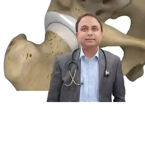 Best Shoulder Labral Tears Surgery Doctors in Kolkata