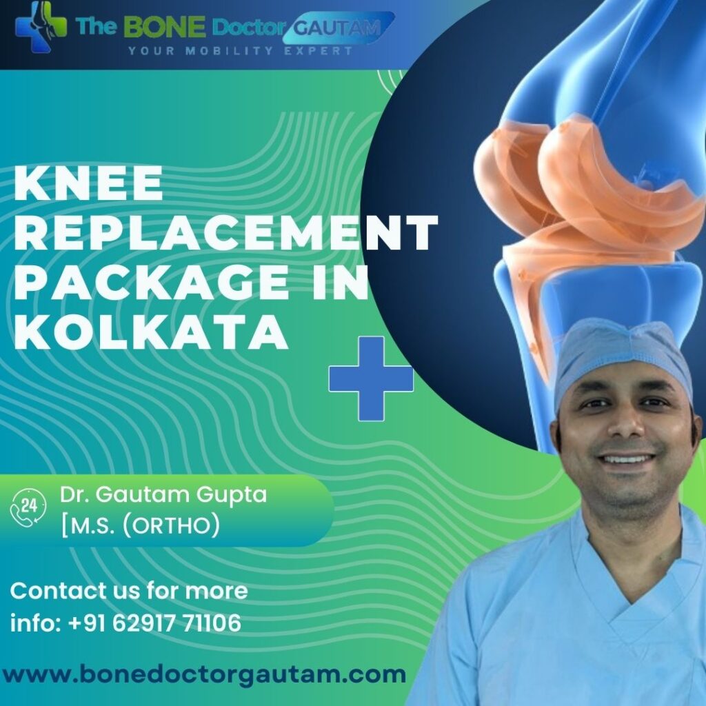 Knee Replacement Package in Kolkata