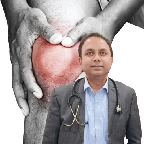 Anterior Cruciate Ligament (ACL) Reconstruction In Kolkata