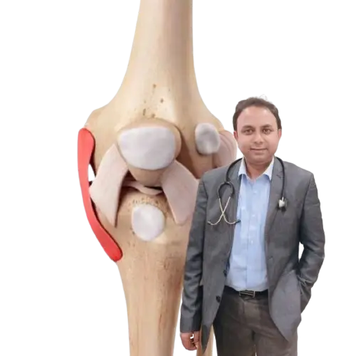 Medial Collateral Ligament (MCL) Repair In Kolkata