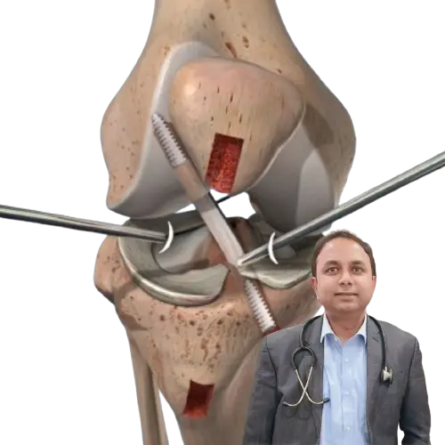Knee replacement specialist