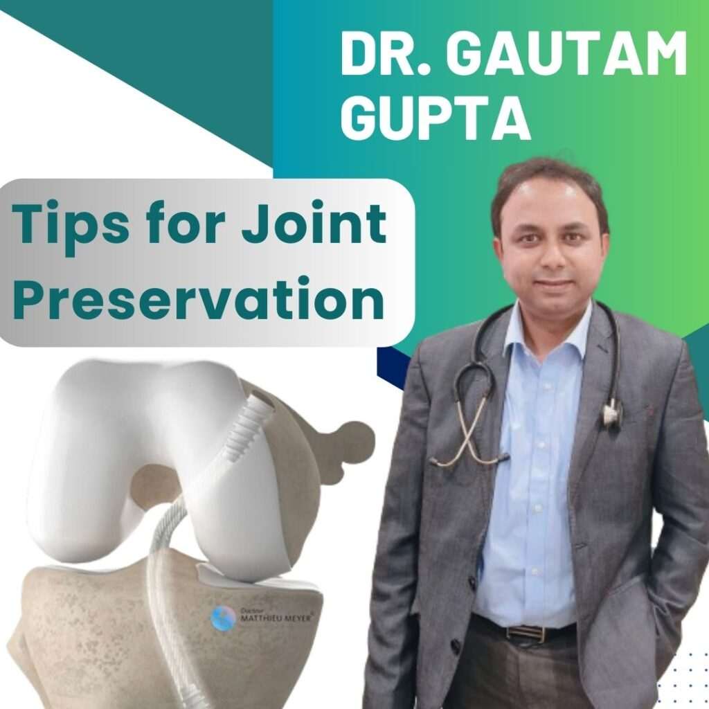 Tips for Joint Preservation and Longevity