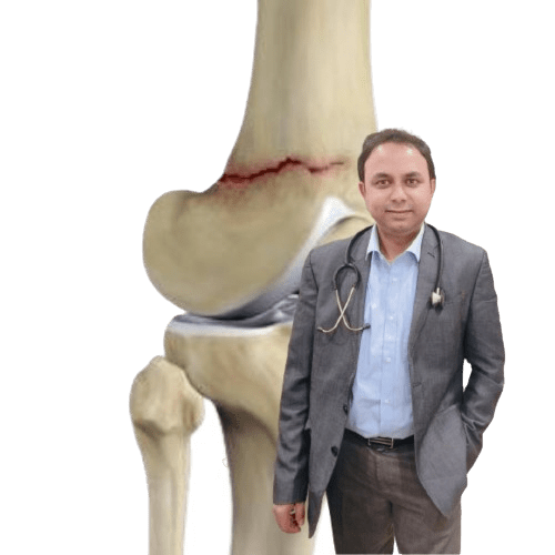 Minimally Invasive Fracture Surgery