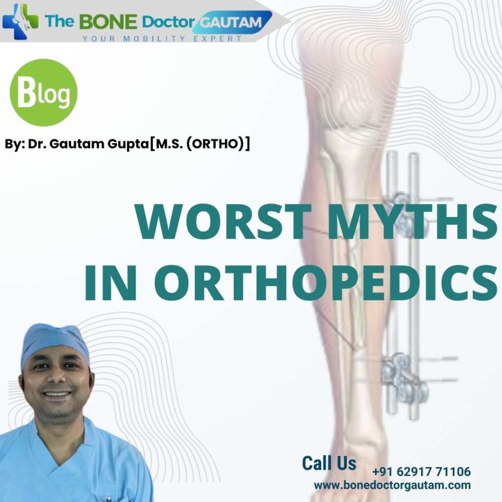 Worst Myths in Orthopedics