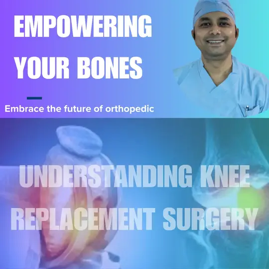 Understanding Knee Replacement Surgery